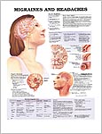 片頭痛と頭痛