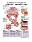 慢性閉塞性肺疾患（COPD)