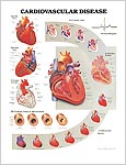 心臓血管の疾患